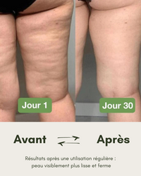 M'BODY PRO 2 thigh electrostimulation