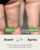 M'BODY PRO 2 thigh electrostimulation
